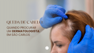 Entenda quando a queda de cabelo deixa de ser normal