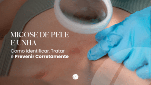 aiba quando procurar uma dermatologista em São Carlos para tratar o problema com segurança.